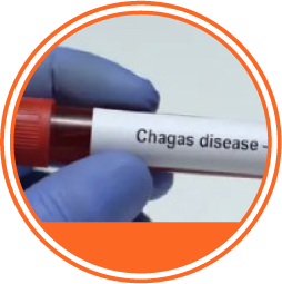 Enfermedad de Chagas círculo