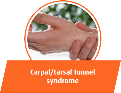 Carpal/tarsal tunnel syndrome