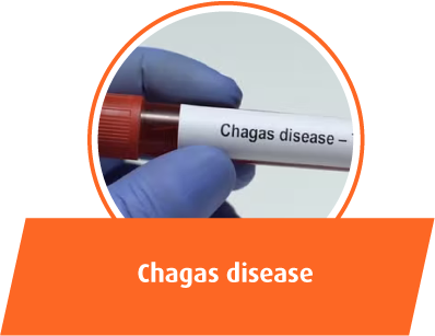 Chagas disease