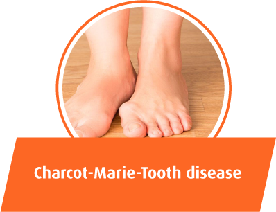 Charcot Marie Tooth disease