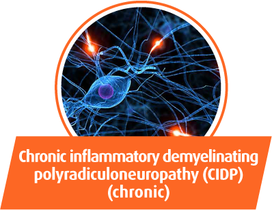 Chronic inflammatory demyelinating