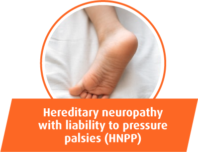 Hereditary neuropathy