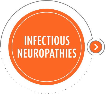Infectious